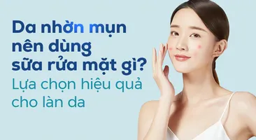 Da nhờn mụn nên dùng sữa rửa mặt gì? Lựa chọn hiệu quả cho làn da