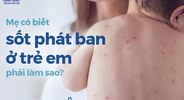 Mẹ có biết sốt phát ban ở trẻ em phải làm sao?