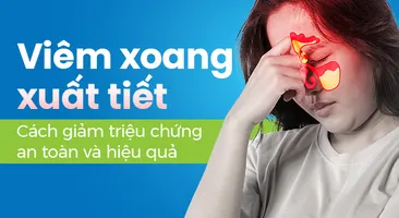 Viêm xoang xuất tiết: Cách giảm triệu chứng an toàn và hiệu quả