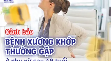 Cảnh báo bệnh xương khớp thường gặp ở phụ nữ sau 40 tuổi