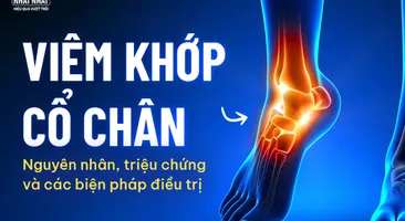 Viêm khớp cổ chân: Nguyên nhân, triệu chứng và các biện pháp điều trị