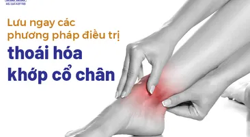 Lưu ngay các phương pháp điều trị thoái hóa khớp cổ chân 