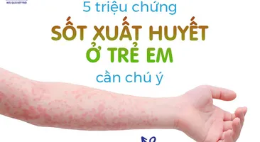 5 triệu chứng sốt xuất huyết ở trẻ em cần chú ý