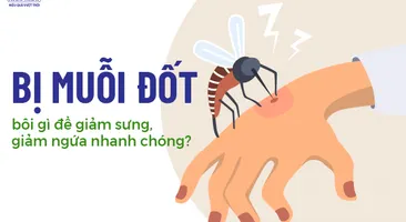 Con bị muỗi đốt bôi gì để giảm sưng, giảm ngứa nhanh chóng?