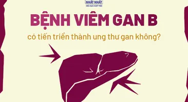Giải đáp nhanh: Bệnh viêm gan B có tiến triển thành ung thư gan không?