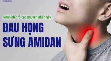 Nhận biết rõ các nguyên nhân gây đau họng sưng amidan