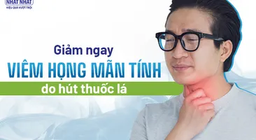Giảm ngay viêm họng mãn tính do hút thuốc lá