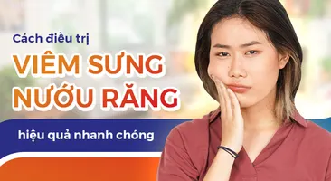 Cách điều trị viêm sưng nướu răng hiệu quả nhanh chóng