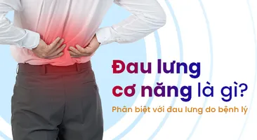 Đau lưng cơ năng là gì? Phân biệt với đau lưng do bệnh lý