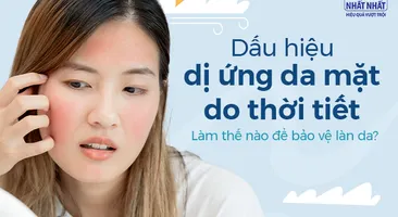 Dấu hiệu dị ứng da mặt do thời tiết: Làm thế nào để bảo vệ làn da?