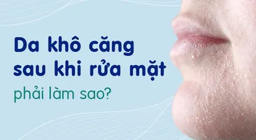 Da khô căng sau khi rửa mặt phải làm sao?