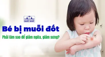 Bé bị muỗi đốt, phải làm sao để giảm ngứa, giảm sưng cho bé?