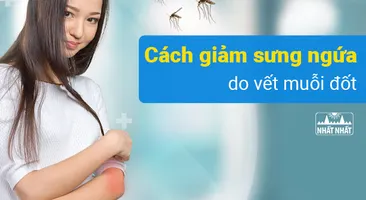 Tổng hợp các cách giảm sưng ngứa do vết muỗi đốt nhanh chóng và an toàn