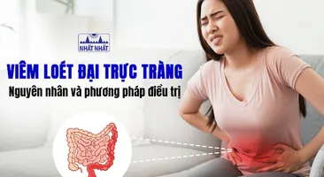 Viêm loét đại trực tràng: Nguyên nhân và phương pháp điều trị