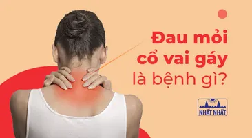 Đau mỏi cổ vai gáy là bệnh gì: Đáp án khiến nhiều người ngạc nhiên
