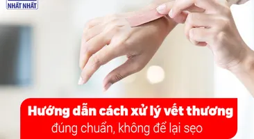 Hướng dẫn cách xử lý vết thương đúng chuẩn, không để lại sẹo