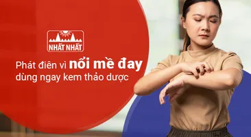 Phát điên vì nổi mề đay – dùng ngay kem thảo dược!