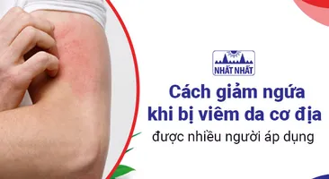 Cách giảm ngứa khi bị viêm da cơ địa được nhiều người áp dụng
