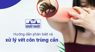 Hướng dẫn phân biệt và xử lý vết côn trùng cắn