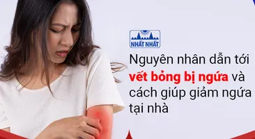 Nguyên nhân dẫn tới vết bỏng bị ngứa và cách giúp giảm ngứa tại nhà