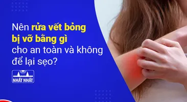 Nên rửa vết bỏng bị vỡ bằng gì cho an toàn và không để lại sẹo?