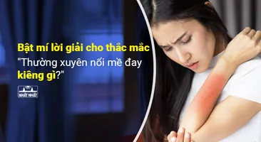 Bật mí lời giải cho thắc mắc “Thường xuyên nổi mề đay kiêng gì?”