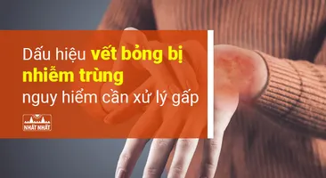 Dấu hiệu vết bỏng bị nhiễm trùng nguy hiểm cần xử lý gấp