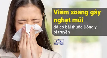 Viêm xoang gây nghẹt mũi ù tai nhức đầu – đã có bài thuốc Đông y bí truyền