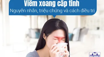Viêm xoang cấp tính - Nguyên nhân, triệu chứng và cách điều trị