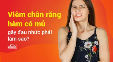 Viêm chân răng hàm có mủ gây đau nhức phải làm sao?