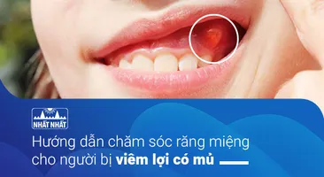 Hướng dẫn chăm sóc răng miệng cho người bị viêm lợi có mủ