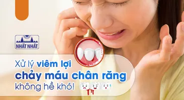 Xử lý viêm lợi chảy máu chân răng không hề khó!