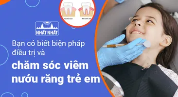 Bạn có biết biện pháp điều trị và chăm sóc viêm nướu răng trẻ em?