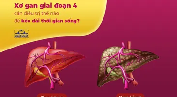 Xơ gan giai đoạn 4 cần điều trị thế nào để kéo dài thời gian sống?