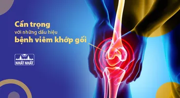 Cẩn trọng với những dấu hiệu bệnh viêm khớp gối không thể bỏ qua