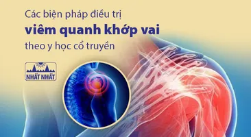 Các biện pháp điều trị viêm quanh khớp vai theo y học cổ truyền 