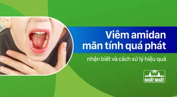 Nhận biết viêm amidan mãn tính quá phát và cách xử lý hiệu quả