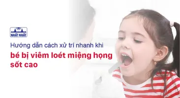 Hướng dẫn cách xử trí nhanh khi bé bị viêm loét miệng họng sốt cao