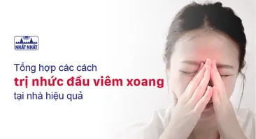 Tổng hợp các cách trị nhức đầu viêm xoang tại nhà hiệu quả