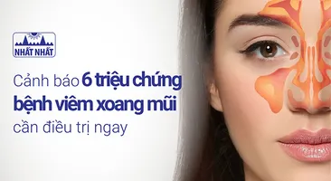 Cảnh báo 6 triệu chứng bệnh viêm xoang mũi cần điều trị ngay