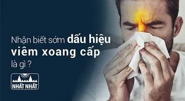 Nhận biết sớm dấu hiệu viêm xoang cấp là gì để xử lý kịp thời