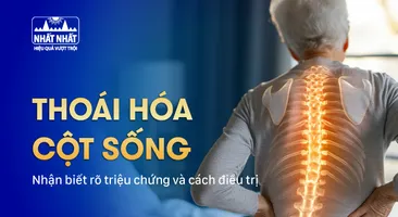 Thoái hóa cột sống: Nhận biết rõ triệu chứng và cách điều trị
