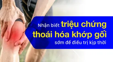 Nhận biết triệu chứng thoái hóa khớp gối sớm để điều trị kịp thời