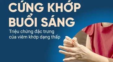 Cứng khớp buổi sáng – Triệu chứng đặc trưng của viêm khớp dạng thấp
