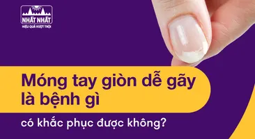 Giải đáp: Móng tay giòn dễ gãy là bệnh gì, có khắc phục được không?