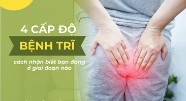 4 cấp độ bệnh trĩ – Cách nhận biết bạn đang ở giai đoạn nào