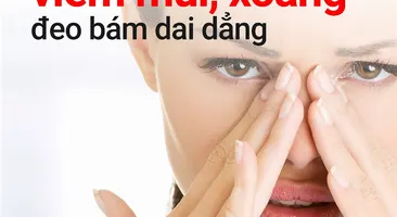 NGĂN NGỪA TÁI PHÁT VIÊM MŨI, XOANG MÃN TÍNH  RẤT KHÓ NHƯNG KHÔNG PHẢI KHÔNG THỂ
