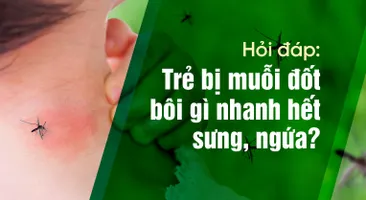 Hỏi đáp: Trẻ bị muỗi đốt bôi gì nhanh hết sưng, ngứa?
