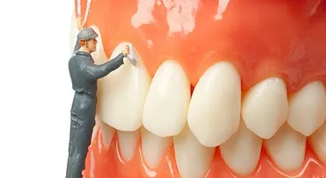 Phòng ngừa cao răng đơn giản hơn bạn nghĩ!