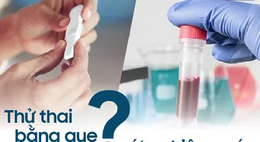 Thử thai bằng cách nào chính xác nhất: Thử thai bằng que hay xét nghiệm máu?